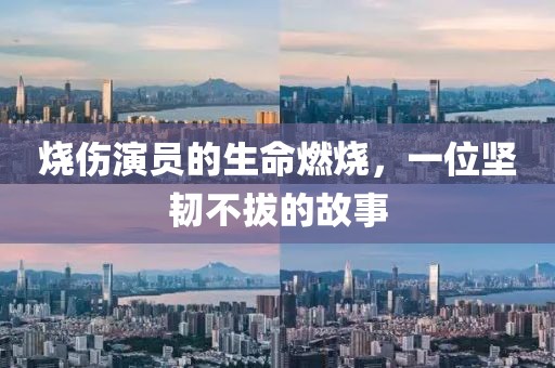 烧伤演员的生命燃烧，一位坚韧不拔的故事