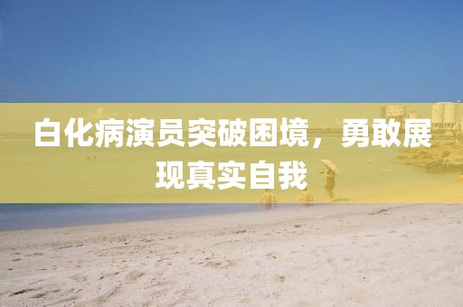 白化病演员突破困境，勇敢展现真实自我